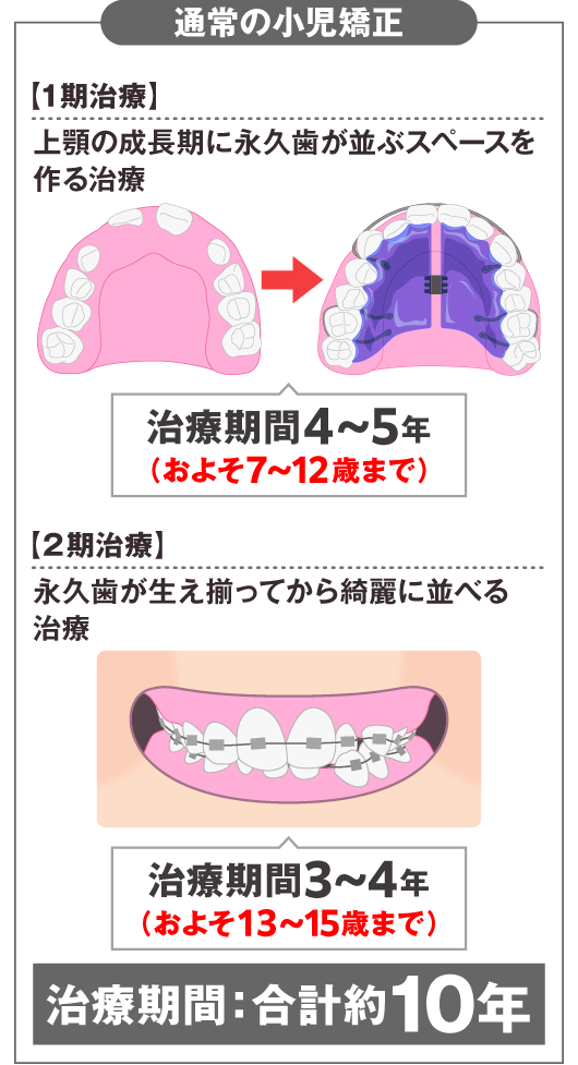 通常の小児矯正
