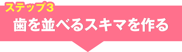 後戻り防止もしっかり